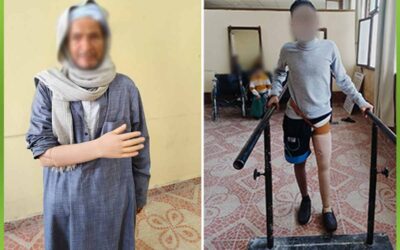 الافريقية توفر اطراف صناعية لحالات فقدت اطرافها