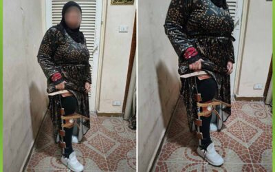 الافريقية تساعد مرضي شلل الاطفال بأجهزة شلل