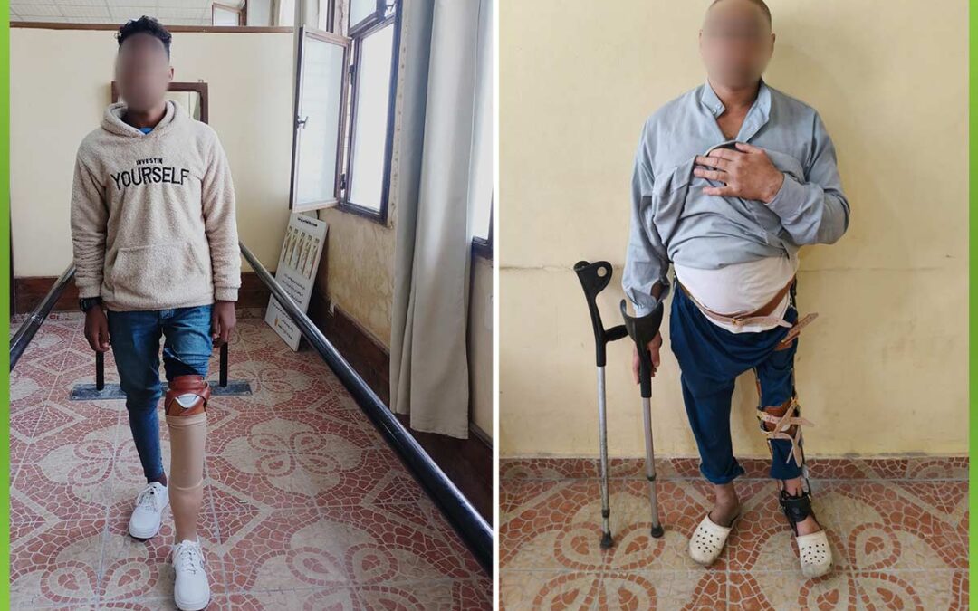 الافريقية توفر اطراف صناعية للحالات الغير قادرة