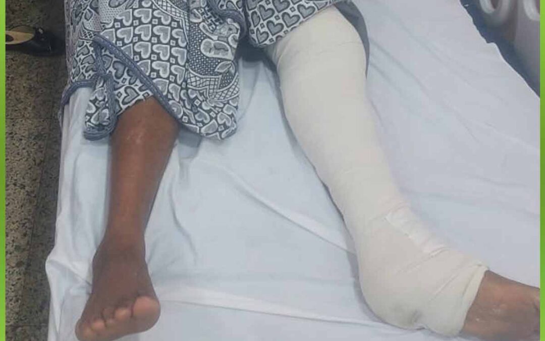 الافريقية تساعد شاب بعملية شرائح ومسامير