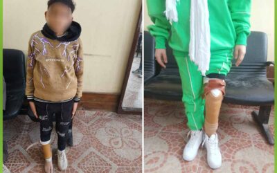 الاطراف الصناعيه حياة جديدة لفاقدين الاطراف