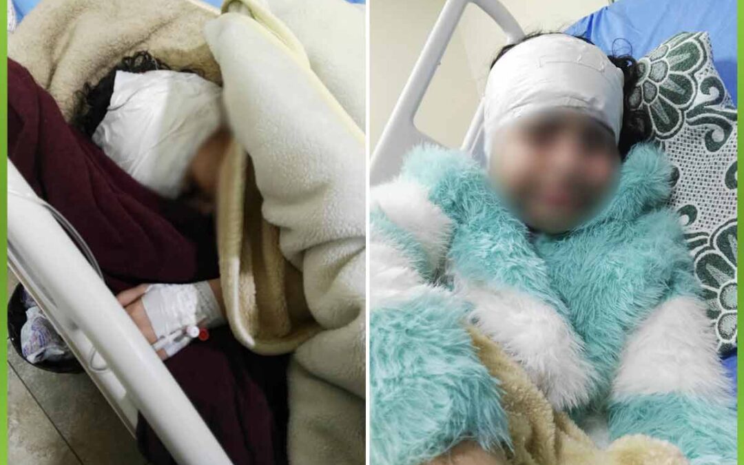 الافريقية تساعد طفلة بإجراء عملية استئصال ورم بالمخ