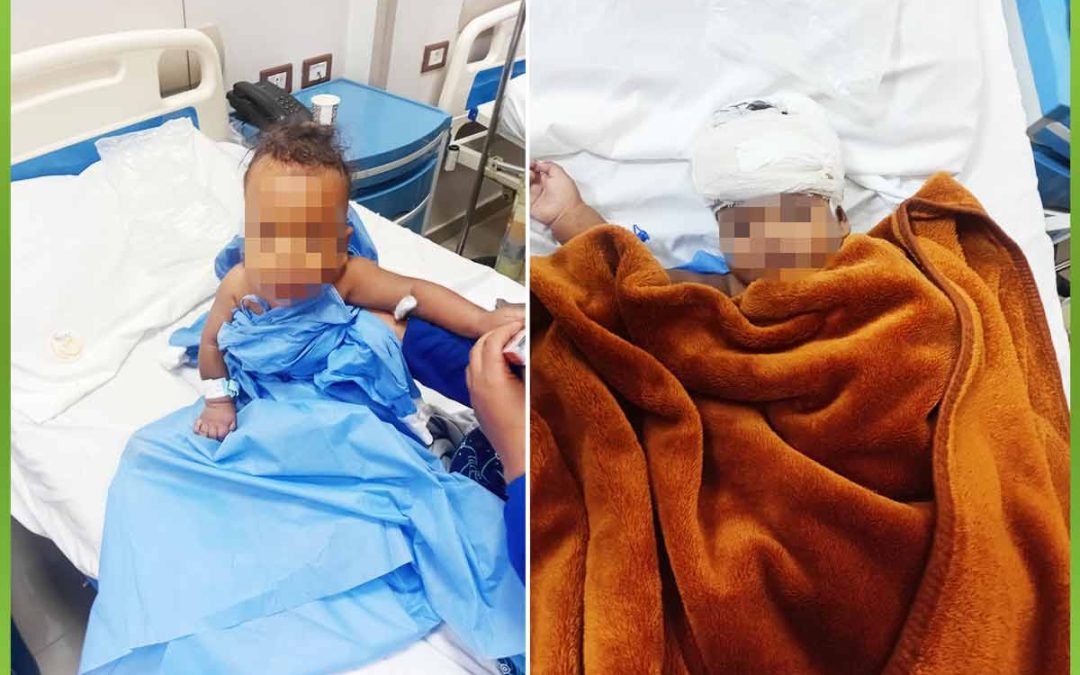 الافريقية تساعد طفل 10شهور بإجراء عملية استئصال كيس بالمخ