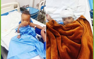 الافريقية تساعد طفل 10شهور بإجراء عملية استئصال كيس بالمخ