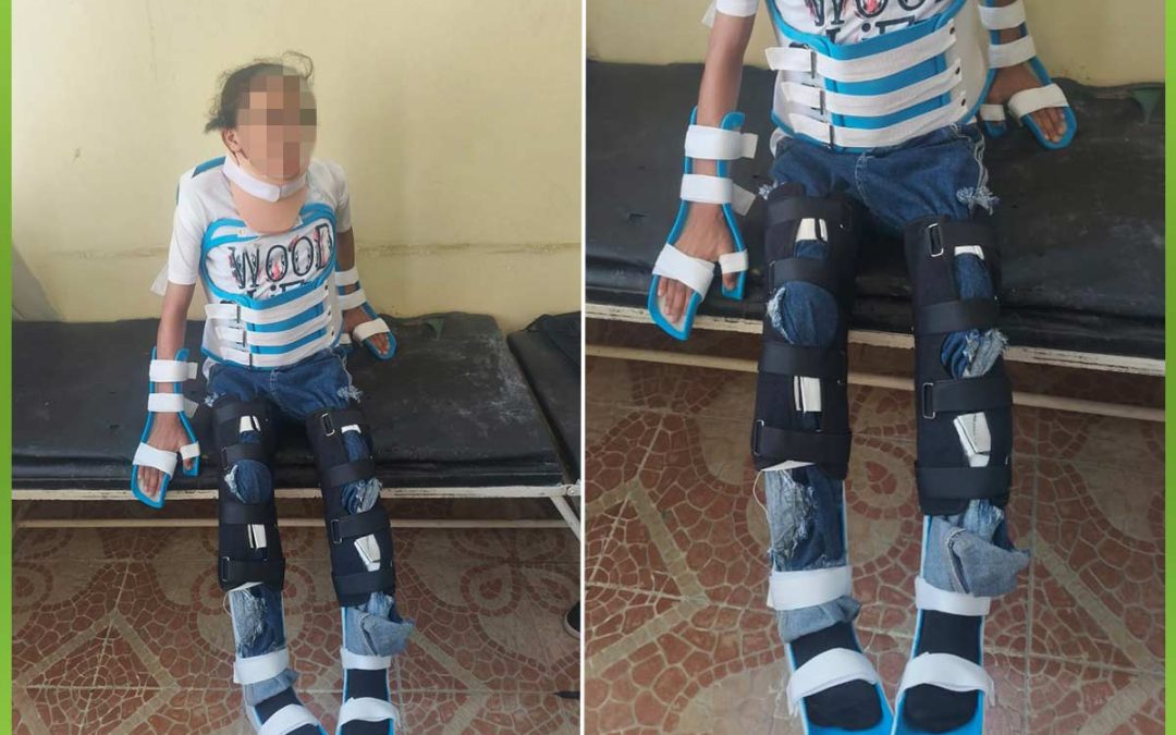 الافريقية تساعد طفل بجبائر طبية وحزام بوسطن