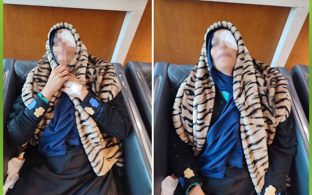 الافريقية تساعد حالة غير قادرة بإجراء عملية ازالة نزيف بالعينين