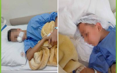 الأفريقية تساهم في إجراء عملية اللحمية لطفلين بنجاح