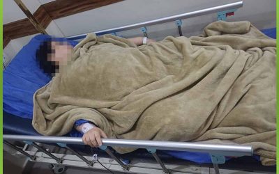 إجراء عملية دقيقة لتثبيت الفقرات القطنية لحالة غير قادرة