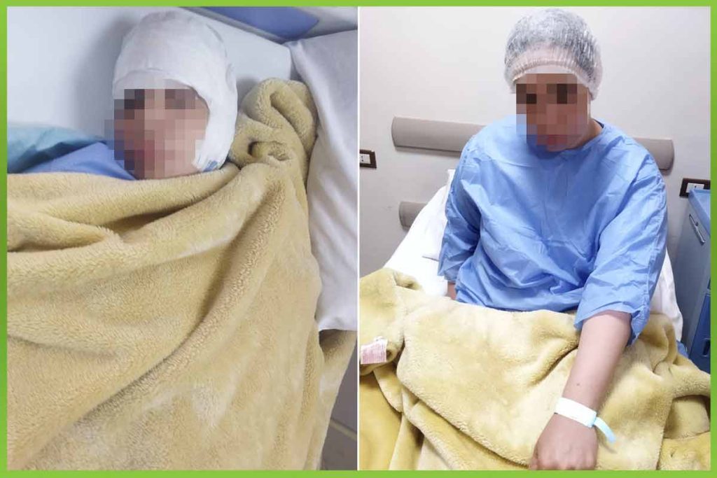 عملية ترقيع طبلة اذن