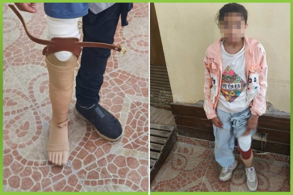 اطراف صناعية حياة جديدة