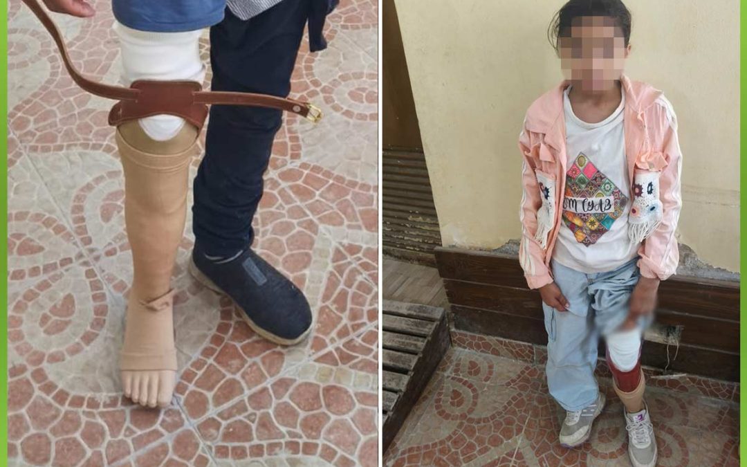 الافريقية تمنح فاقدين الاطراف فرصه جديدة للحركة