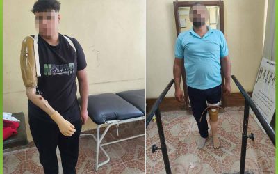 توفير اطراف صناعية وأمل جديد لحالات غير قادرة