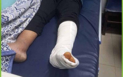 الأفريقية تدعم حالة بإجراء جراحة وتركيب شرائح ومسامير.