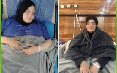 الأفريقية تساهم في إجراء عملية تثبيت الفقرات القطنية واستئصال الغضروف
