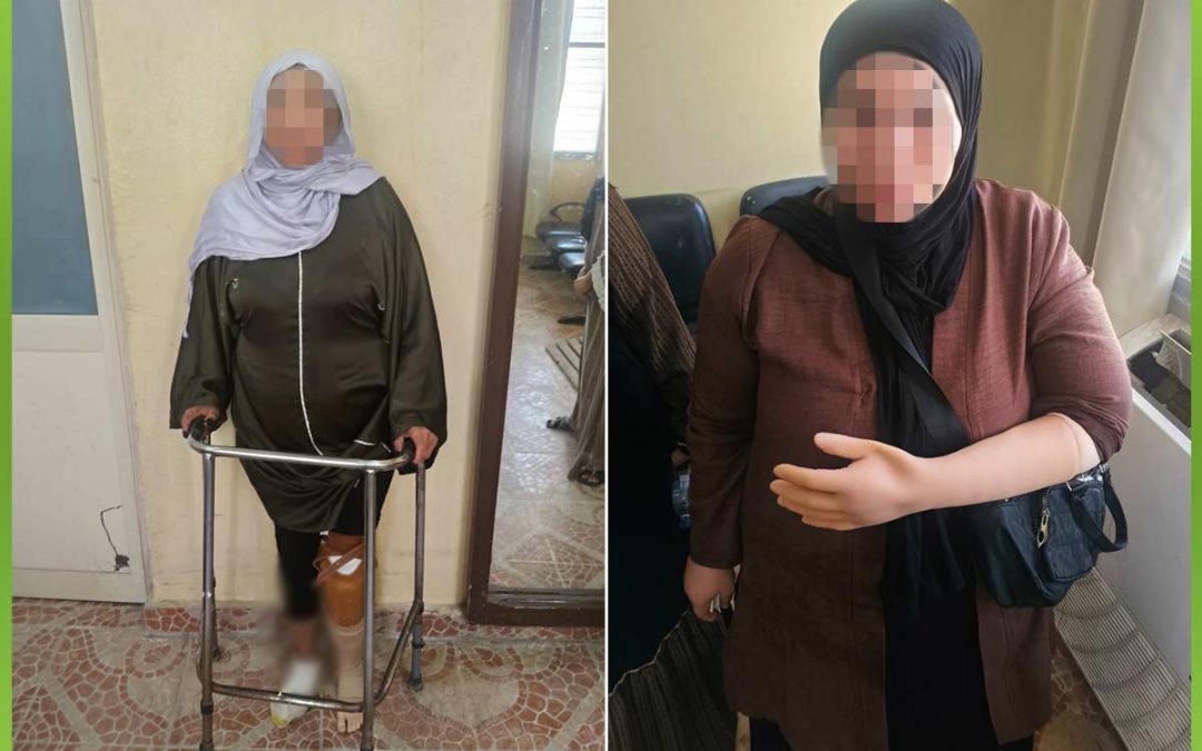 توفير أطراف صناعية لغير القادرين.. خطوة نحو حياة أفضل وأمل جديد
