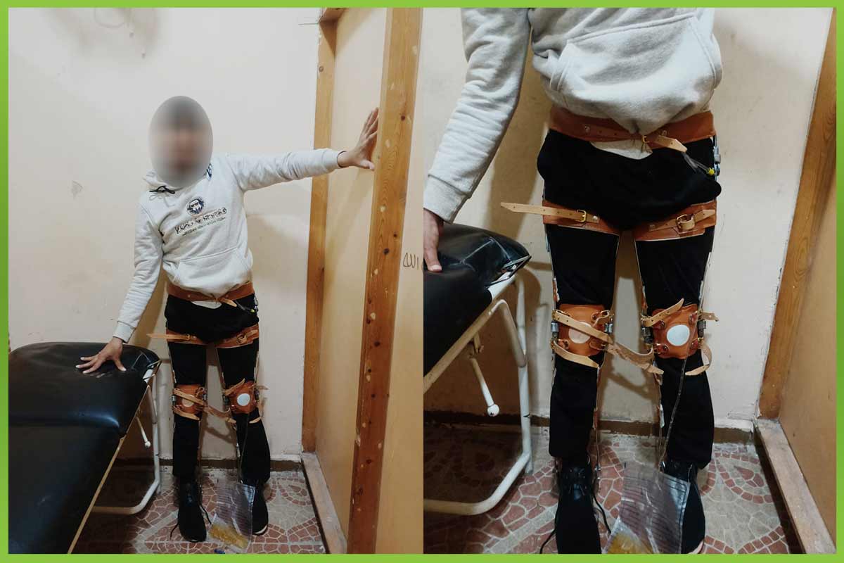 Immobilization-device المؤسسة العربية الافريقية للابحاث والتنمية المستدامة