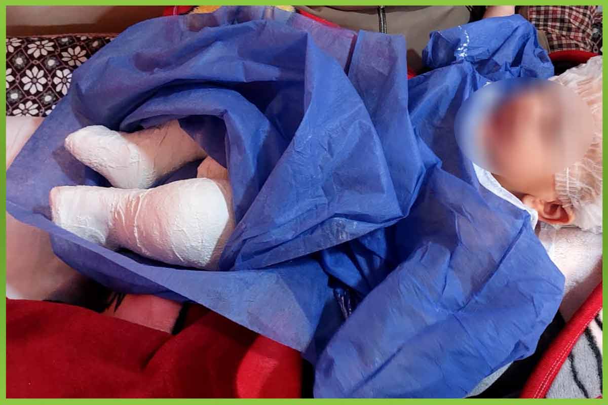 Tendon-lengthening-process المؤسسة العربية الافريقية للابحاث والتنمية المستدامة