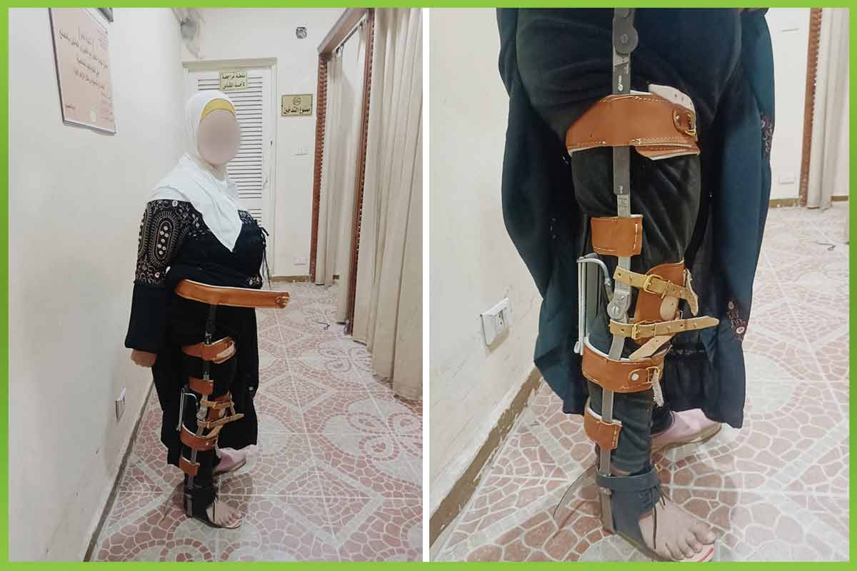 Immobilization device المؤسسة العربية الافريقية