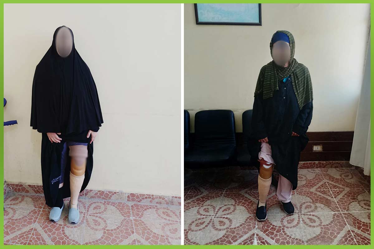 Prosthetic devices المؤسسة العربية الافريقية