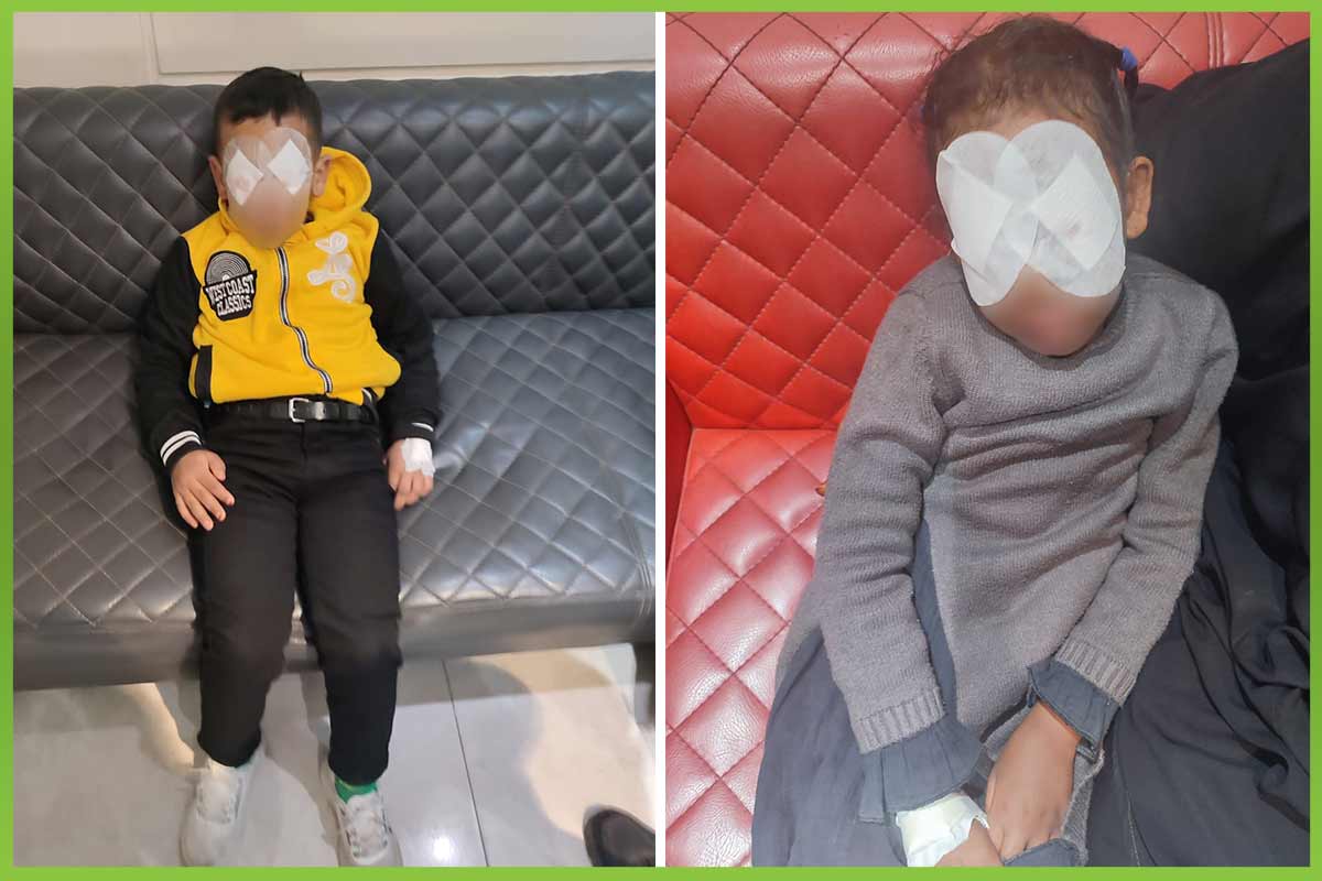 Eye squint repair المؤسسة العربية الافريقية