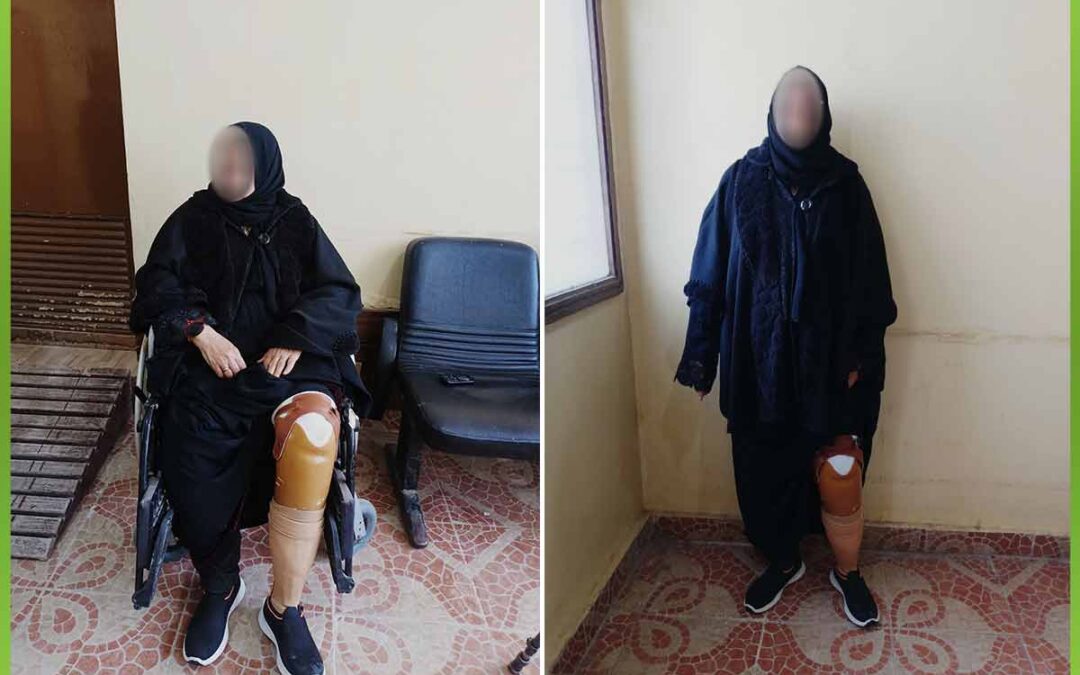 الافريقية توفر طرف صناعي لربة منزل يساعدها علي الحركة