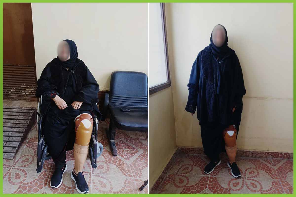 Prosthetic limb المؤسسة العربية الافريقية
